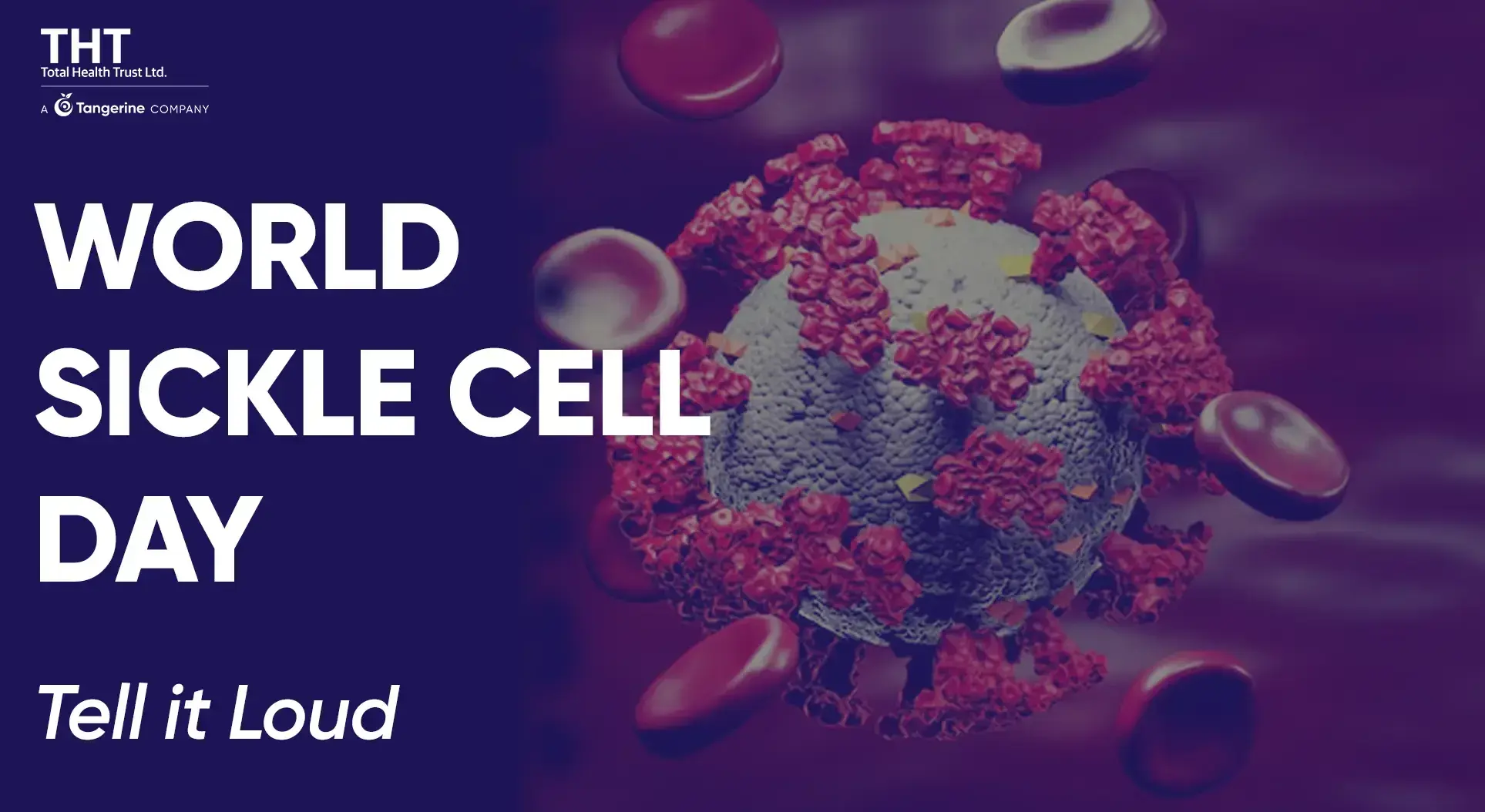 World Sickle Cell Day – Tell it Loud