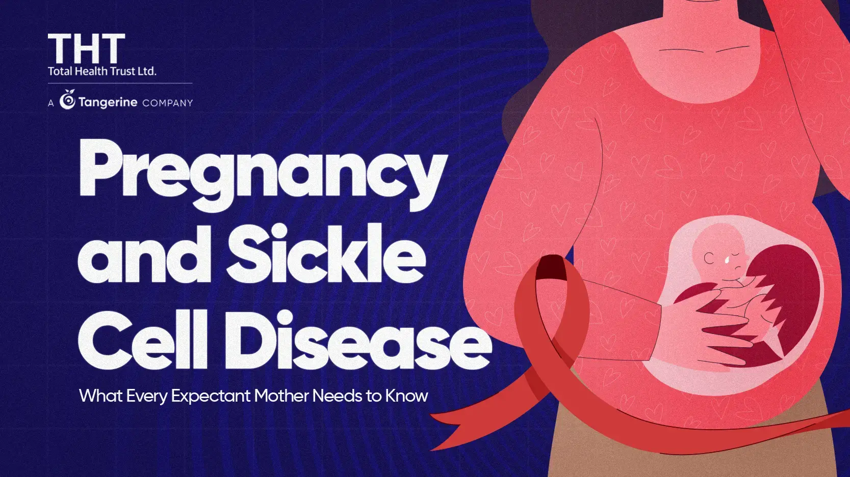 Pregnancy and Sickle Cell Disease: What Every Expectant Mother Needs to Know
